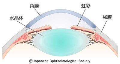 図１　前眼部の構造